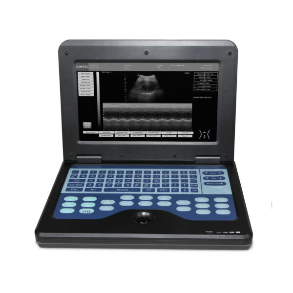 Digital Laptop Machine Ultrasound Scanner Convex 3.5Mhz Probe Abdominal For Human Use - Image 3