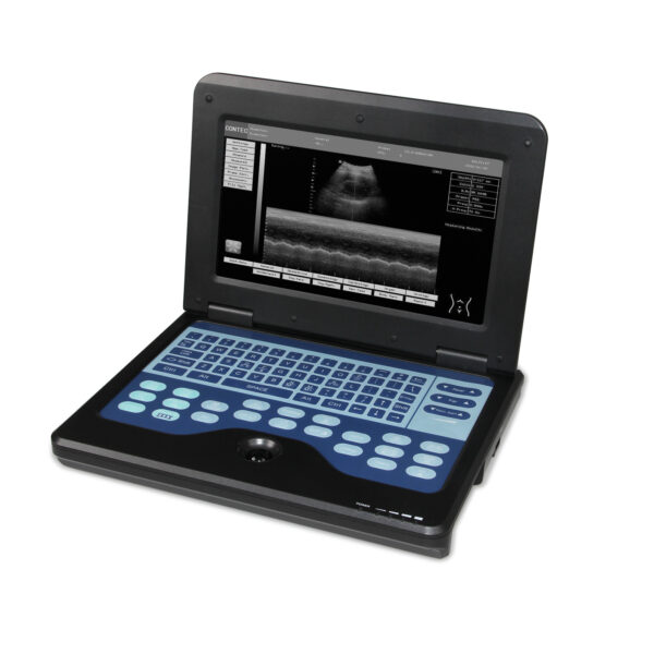 Portable Ultrasound Scanner Laptop Digital Diagnostic Machine 3.5 Convex Probe - Image 6