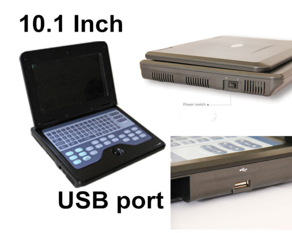 Portable Ultrasound Scanner Laptop Digital Diagnostic Machine 3.5 Convex Probe - Image 7